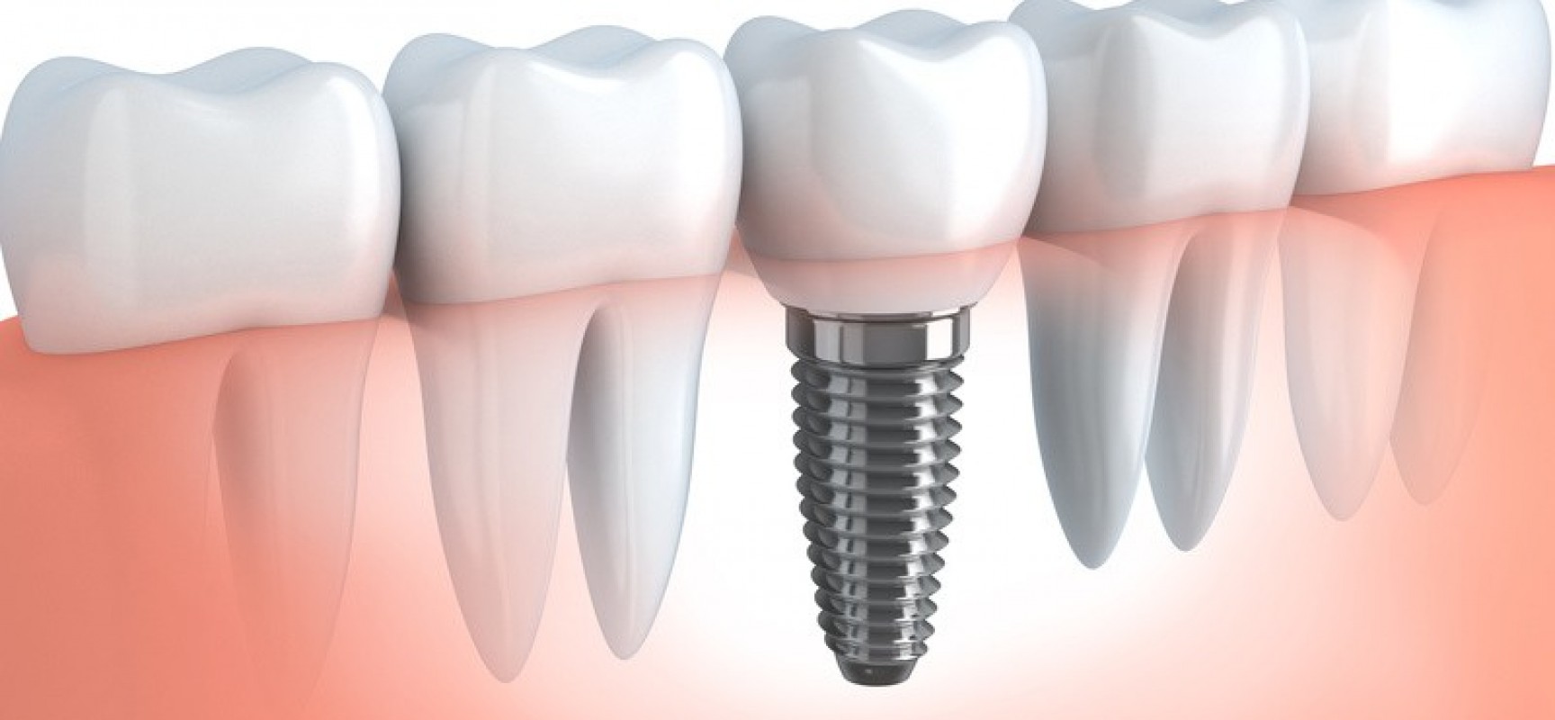 Fotolia_56842510_S-e1406569426468-1728x800_c